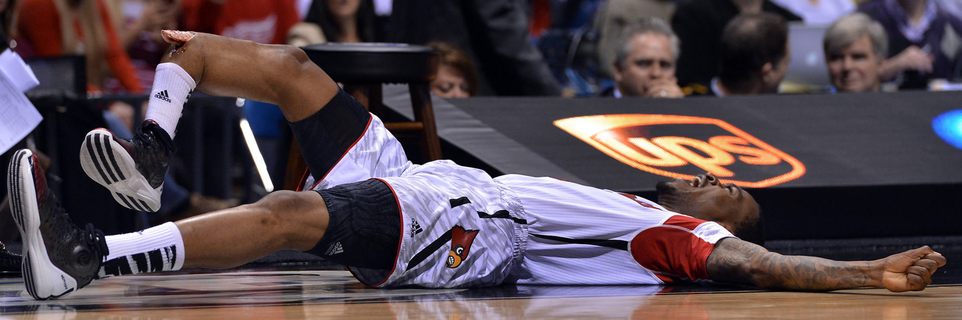 A high-definition picture of Kevin Ware's leg break.