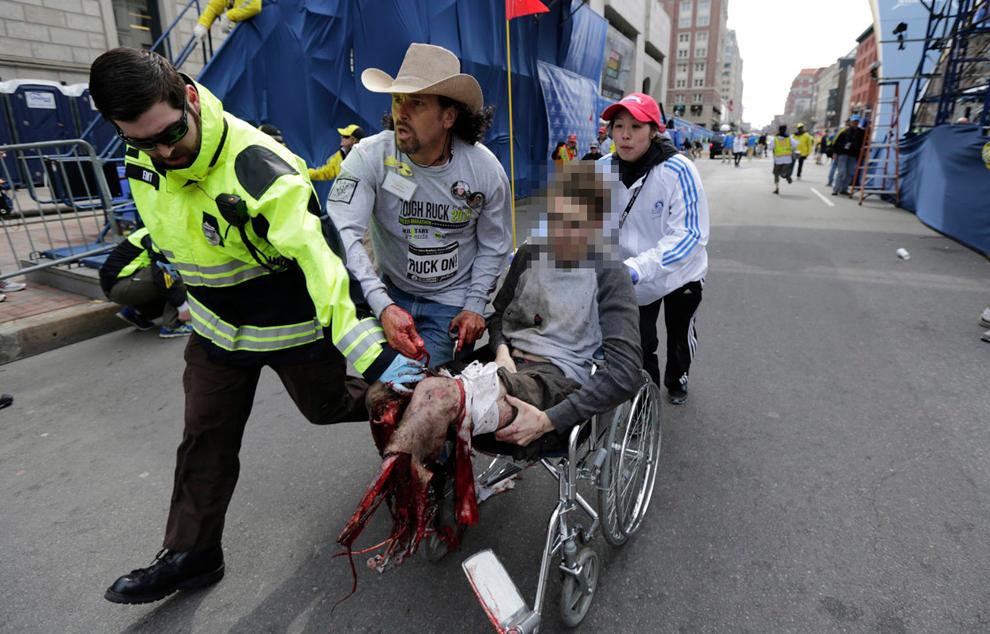 A picture of a man whose legs have been blown off in Tuesday's Boston bombing.  Several inches of bare bone shows.